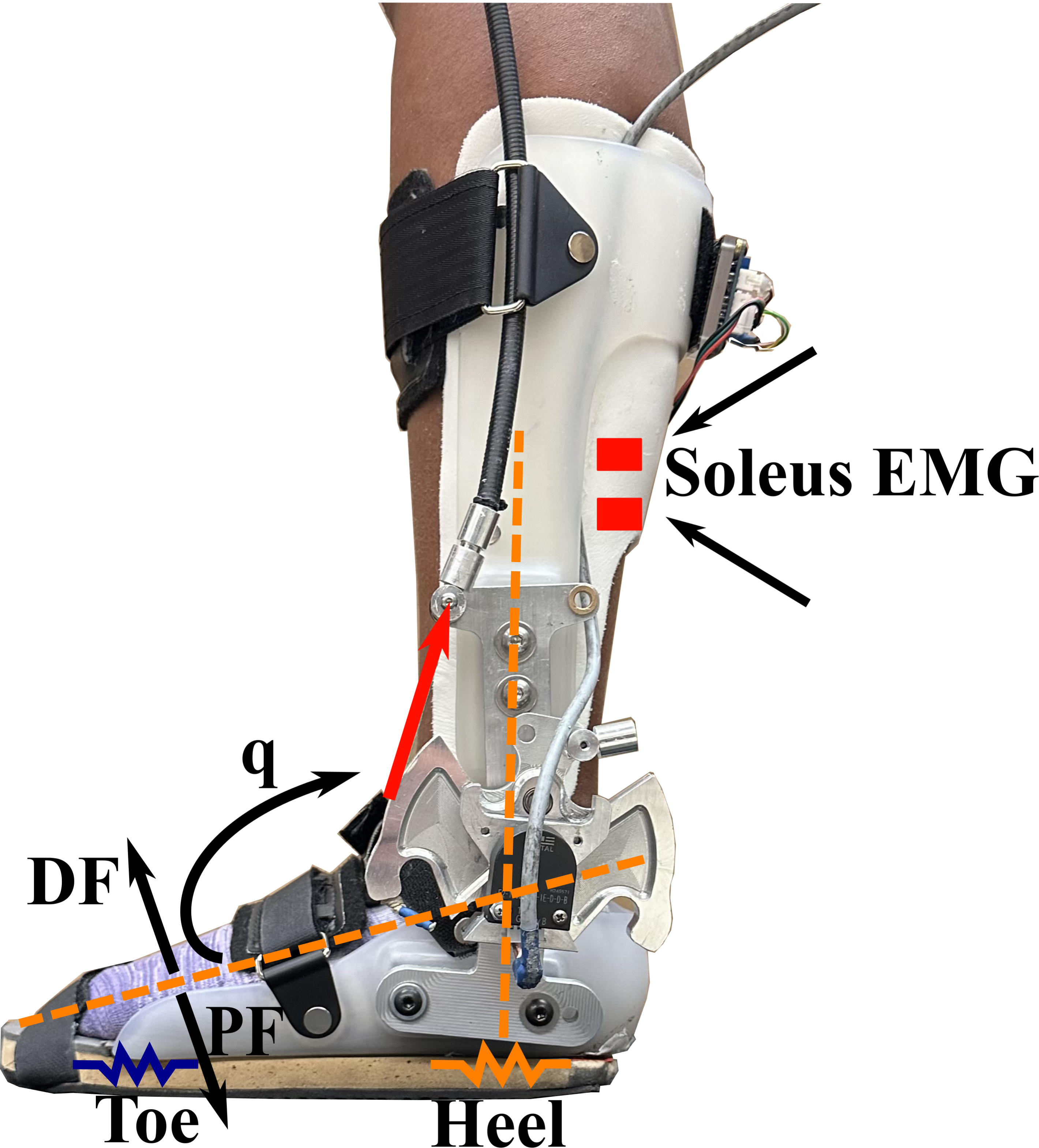 Ankle Foot Orthosis